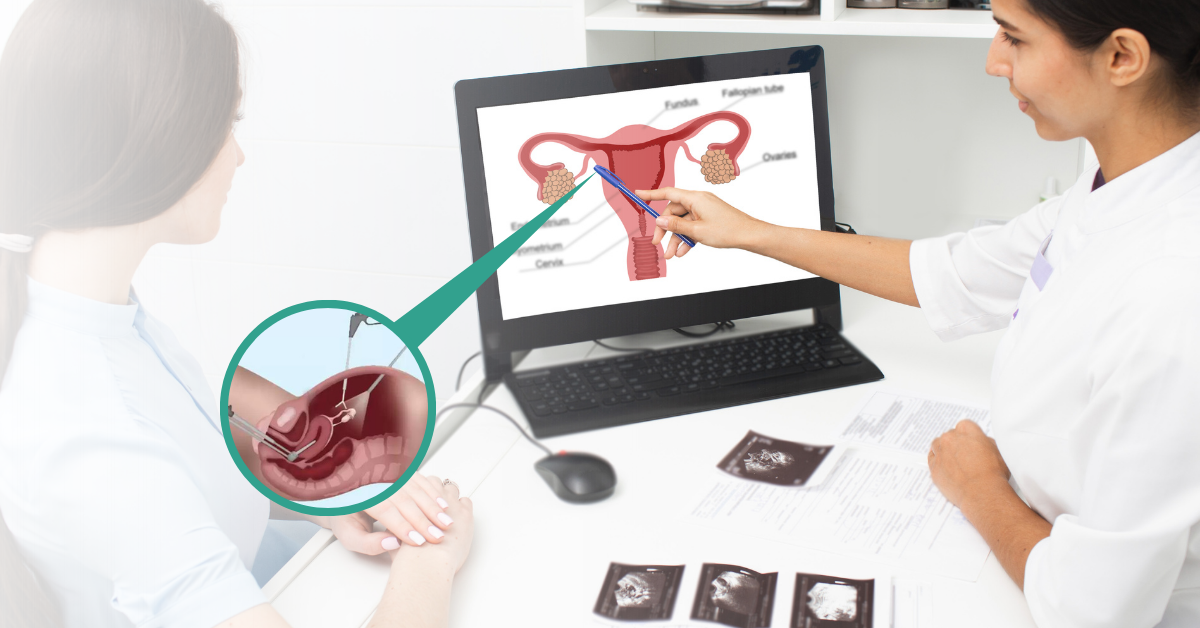 Surgical Techniques Used in Uterus Removal Surgery